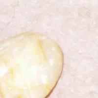 سنگ قدیمی  خوب|کلکسیون اشیاء عتیقه|اصفهان, راه آهن|دیوار