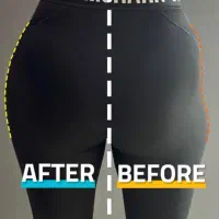 ساکشن چربی ترانسفر به هیپ دیپ و باسن فیلربادی غبغب|خدمات آرایشگری و زیبایی|تهران, شهرک صدرا|دیوار