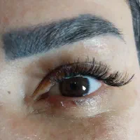 کاشت مژه