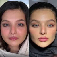 خدمات ژل بیکینی و زیر چشم و بوتاکس|خدمات آرایشگری و زیبایی|شاهین‌شهر, فردوسی|دیوار