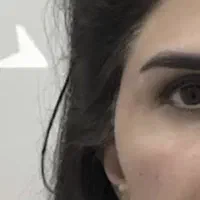 تزریق ژل. بوتاکس|خدمات آرایشگری و زیبایی|کرج, حصارک پایین|دیوار