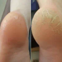 اسپا.کراتین .کاشت ناخن|خدمات آرایشگری و زیبایی|مرودشت, تامین اجتماعی‎|دیوار