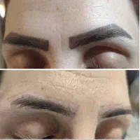 مدل فوری ریموو تتوی قدیمی وبدرنگ|خدمات آرایشگری و زیبایی|آمل, |دیوار