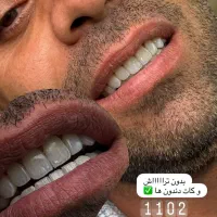 خدمات کامپوزیت آفر|خدمات آرایشگری و زیبایی|دورود, |دیوار