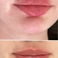اف ویژه اموزش وخدمات ژل بوتاکس خال کراتین مژه