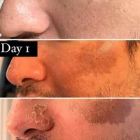 آموزش تکنیک پوست ماری|خدمات آموزشی|تهران, امیریه|دیوار