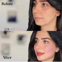 مدل رایگان آر اف جوانساز و آبرسانی برای مطب زیبایی