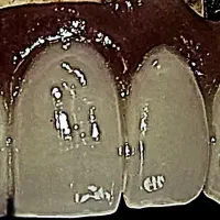 نیروی کار جهت لابراتوار دندانسازی