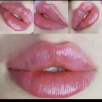 ژل بوتاکس آنزیم