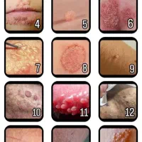 با زائده هات خدافظی کن