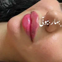 تخفیف خدمات تخصصی ژل بوتاکس مادلینگ مزوتراپی آنزیم|خدمات آرایشگری و زیبایی|کرمانشاه, |دیوار
