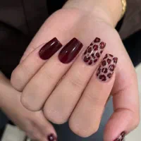 کاشت ژل ۵۰۰ ترمیم۴۰۰ کاشت موقتی۳۵۰ ژلیش ۳۰۰