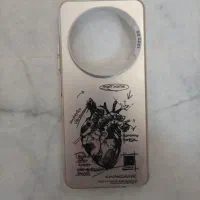 قاب گوشی Redmi 14C