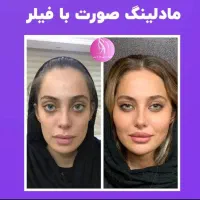 کلینیک تخصصی لیزر مو تزریق ژل لب  فیلتر بوتاکس مزو|خدمات آرایشگری و زیبایی|تهران, صادقیه|دیوار
