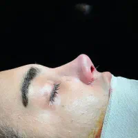 جشنواره جراحی بینی|خدمات آرایشگری و زیبایی|اهواز, پادادشهر|دیوار