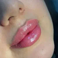 خدمات ژل و بوتاکس پلکسر و...|خدمات آرایشگری و زیبایی|کرمانشاه, |دیوار