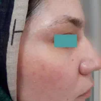 کرم گلدن کویین اصل ضدلک ضدجوشو روشن کننده|آرایشی، بهداشتی، درمانی|بروجرد, |دیوار