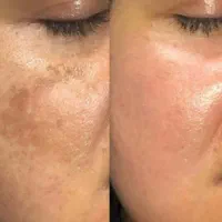 تضمینی سفید و بی لک شو