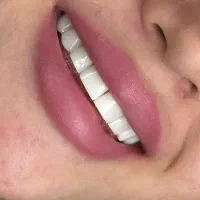 جشنواره کامپوزیت به مدت یک هفته|خدمات زیبایی و سلامت|تهران, شهرک شریعتی|دیوار
