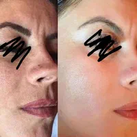 کرم ضد لک روشن کننده قوی گلدن کویین|آرایشی، بهداشتی، درمانی|شیراز, اصلاح‌نژاد|دیوار