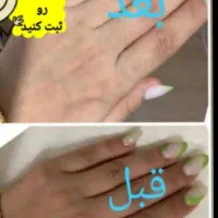 کرم سفید کننده ضمانتی  وایتکس ۱۰۰درصد