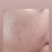 ماسک چاله چوله و منافذ باز صورت|حراج|مشهد, کشاورز|دیوار