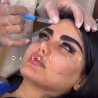 کلینیک تخصصی ژل لبMفیلر بینی گونه زاویه فک چانه|خدمات زیبایی و سلامت|تهران, الهیه|دیوار