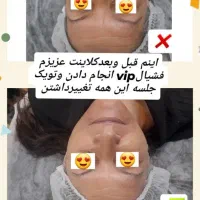 مدل فیشیال و پاکسازی|خدمات آرایشگری و زیبایی|تربتحیدریه, کاشانی|دیوار