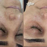 تخفیف انواع پکیجهای پوستی