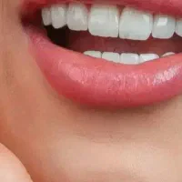 کلیه خدمات دندانپزشکی با تخفیفات طلایی|خدمات زیبایی و سلامت|کرمانشاه, |دیوار
