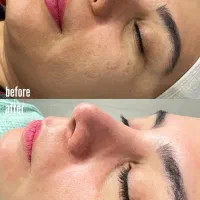 فیشال فیشیال پاکسازی پوست صورت اسکراب کربوکسی مو