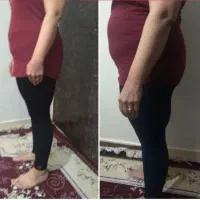 لاغری اصولی