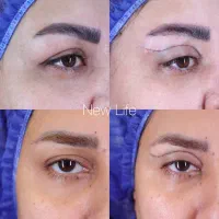 دیگه نگو چقدر خسته ای با این جراحی دوباره پرانرژی