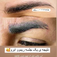 آموزش ریموو تاتو