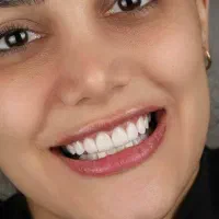 کامپوزیت دندان