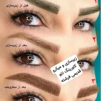 ریمو تتو قدیمی زیرسازی واصلاح میکروکاورینگ