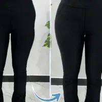 تزریق حرفه ای فیلر بادی