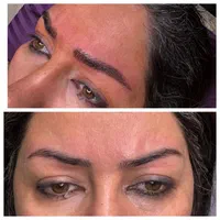 مدل میکروبلیدینگ فیبروز شیدینگ لب خط چشم ریموو|خدمات آرایشگری و زیبایی|تهران, سردارجنگل|دیوار