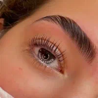 کاشت مژه ۲۵۰