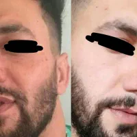 کرم سفیدکننده صورت وبدن مخصوص خانما و اقایون|آرایشی، بهداشتی، درمانی|بم, |دیوار