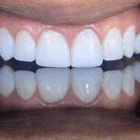 جشنواره دندانپزشکی اقساطی بدون پیش پرداخت|خدمات آرایشگری و زیبایی|شیراز, ستارخان|دیوار