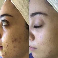 فیشال تخصصی خانم هاو‌اقایان تخفیف یلدا۶۰۰تومن