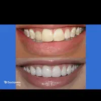 خدمات دندانپزشکی بابهترین کیفیت وقیمت