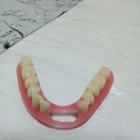 دندان متحرک در سنندج|خدمات آرایشگری و زیبایی|اسدآباد, |دیوار