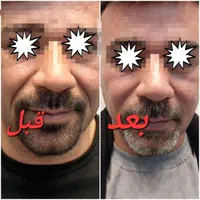 جشنواره کلینیک زیبایی تزریق فیلر، بوتاکس توسط پزشک|خدمات آرایشگری و زیبایی|نجف‌آباد, |دیوار