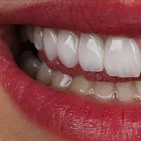کلیه خدمات دندانپزشکی اقساطی در اردبیل