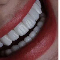 کامپوزیت از دم قسط