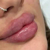 ژل لب ژل کل صورت سی سی۵۰۰(تاتوکل صورت)