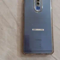 mite 10 lite میت۱۰لایت