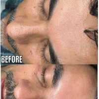 مدل پاکسازی صورت و بدن(خانم و اقا)باهم یا جدا|خدمات آرایشگری و زیبایی|مشهد, کوثر|دیوار